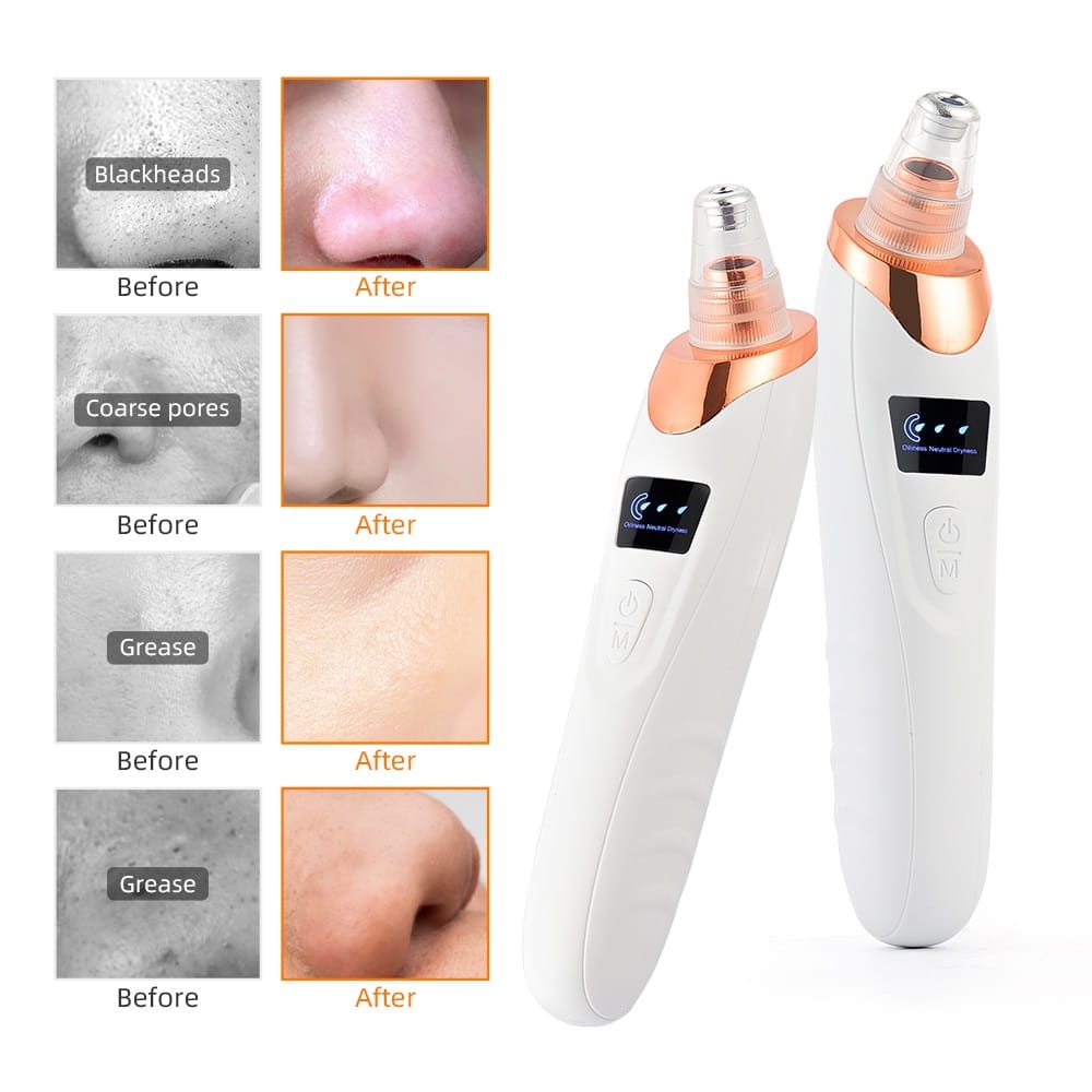 "Electric Blackhead Remover Pore Vacuum | 5-Speed Suction, LED Display, Deep Facial Cleaning & Skin Care Tool"